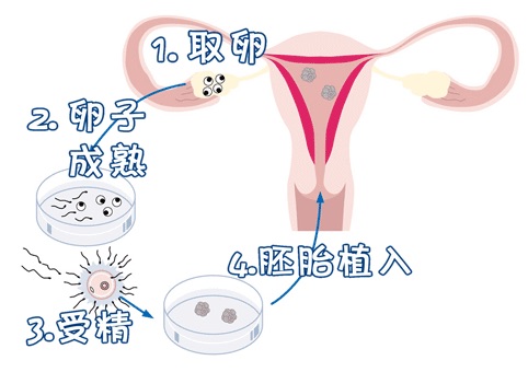 关于景泰生殖